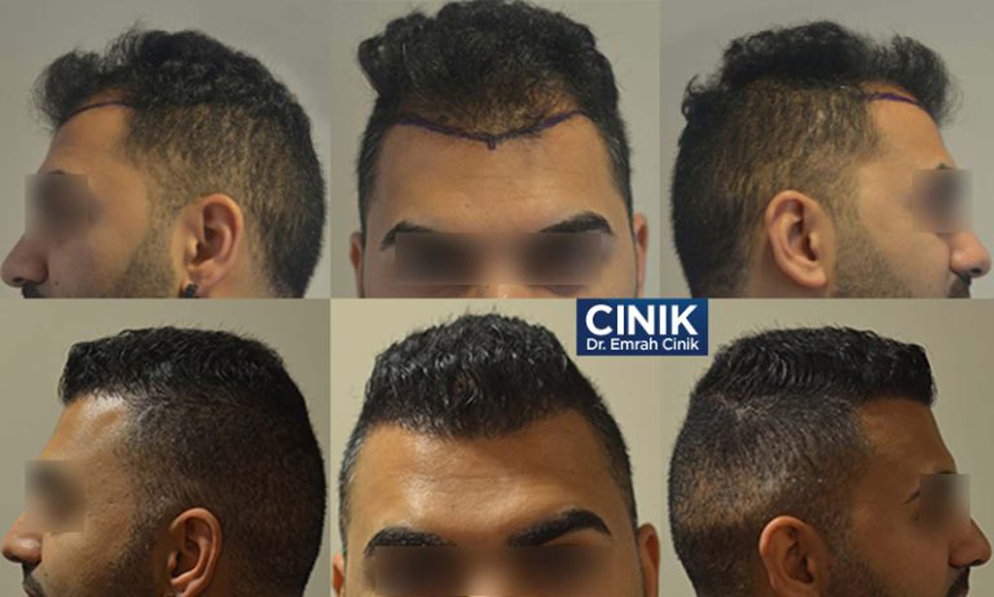 Dr. Cinik Hair Transplant Clinic StartUs