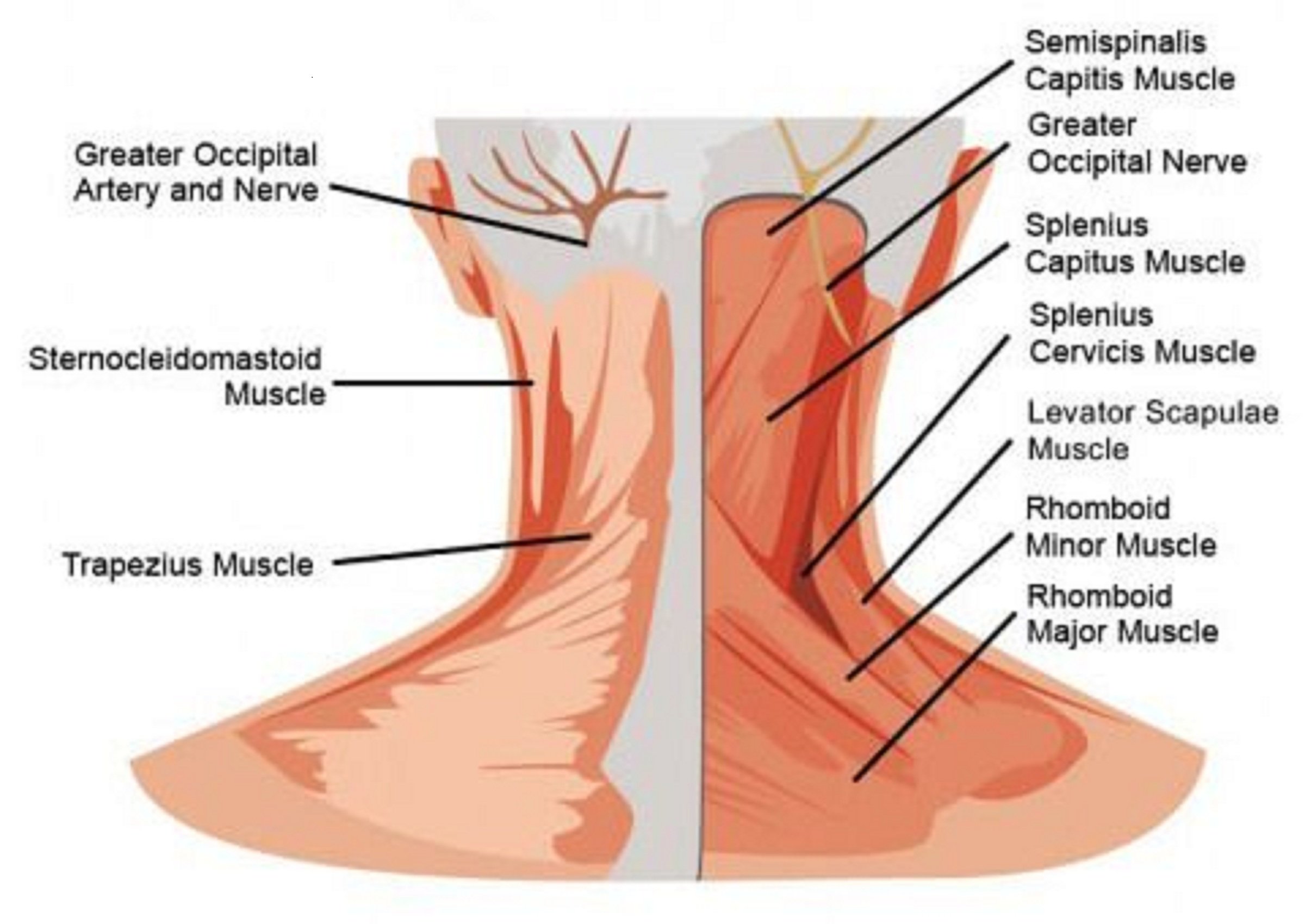 Neck injury